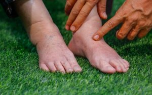 体液貯留を解消するのに役立つ食品10選