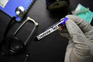 クレアチニンが私たちの健康に有害ってホント?